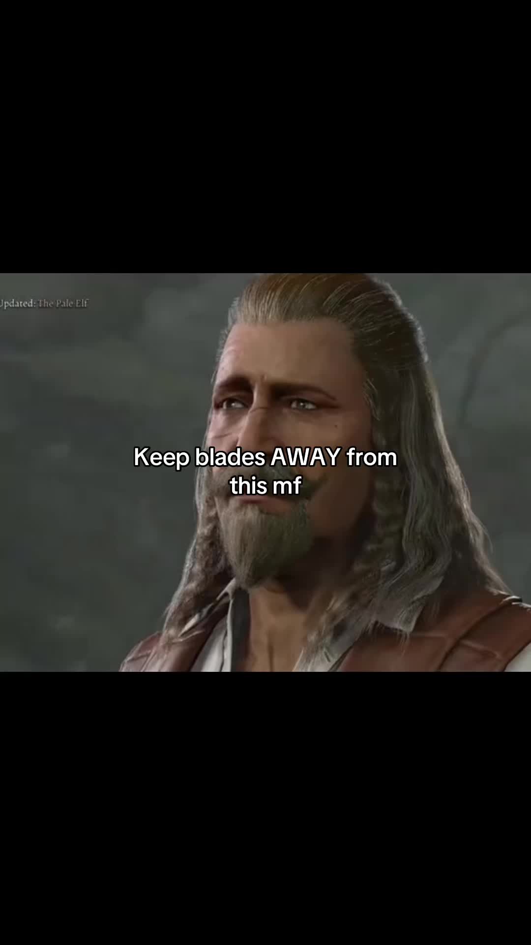 @Kieran’s Missing Eyes