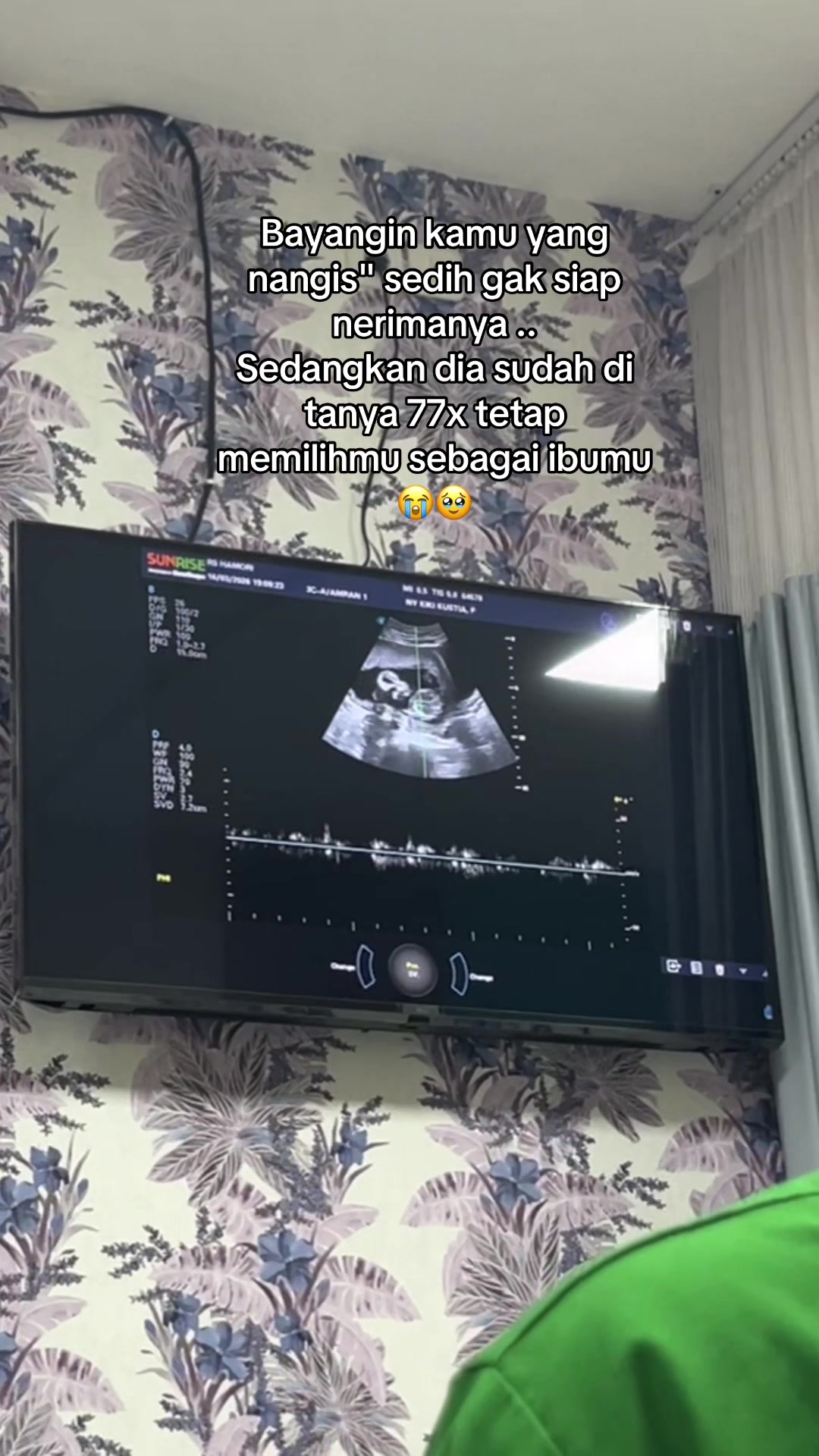 @Akunbaru