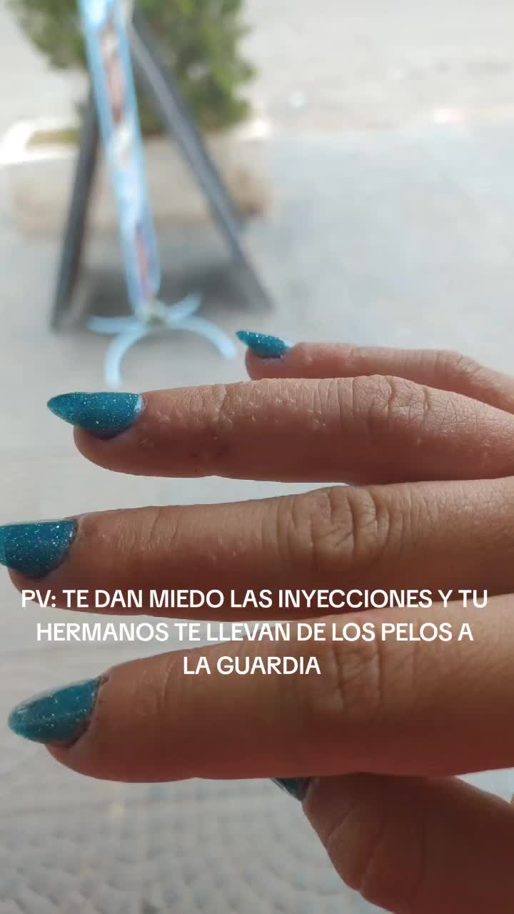 @Mile Jacob