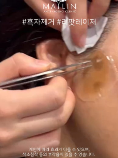 @메이린의원대구점