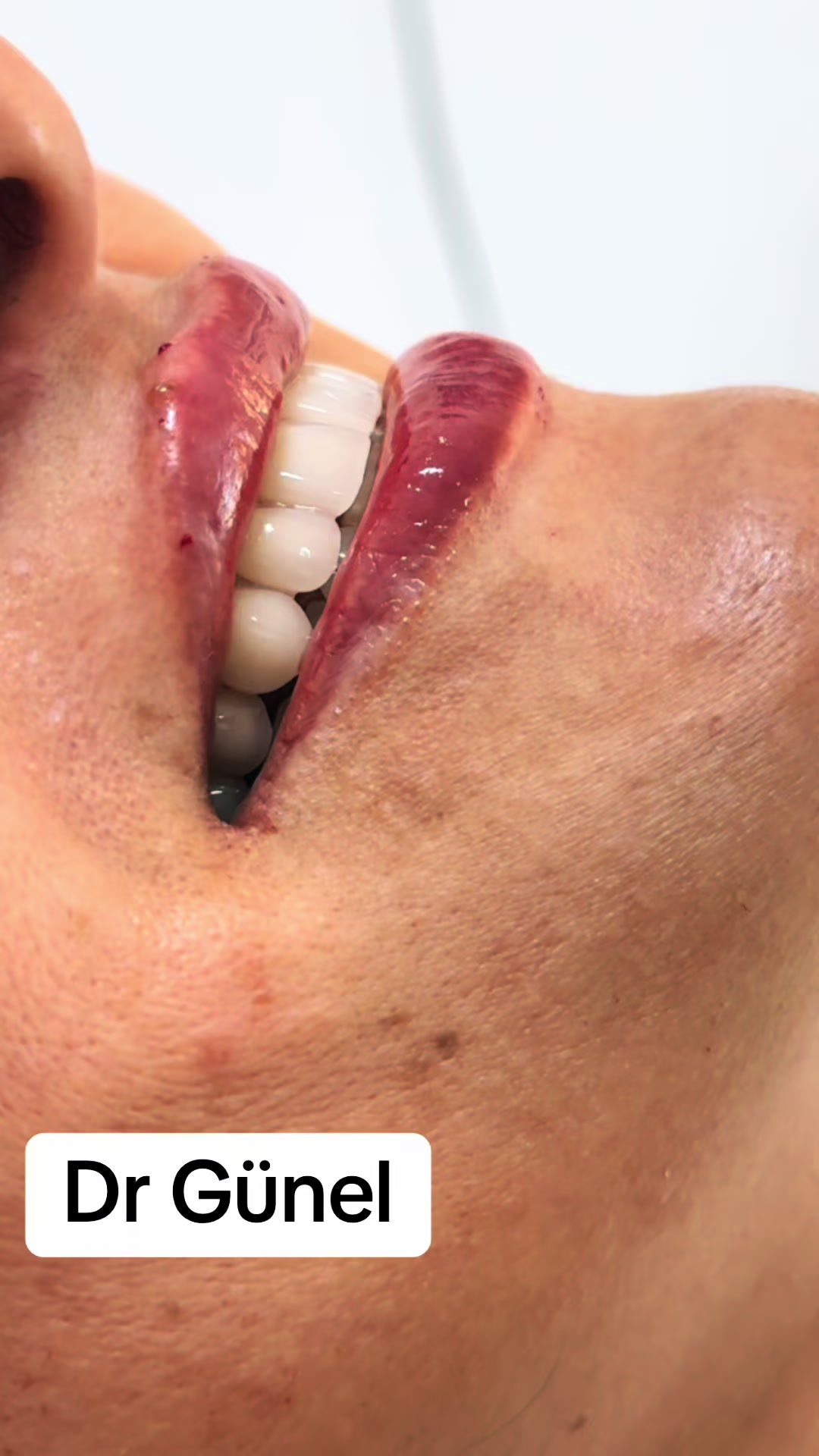 @Dentist_Günel