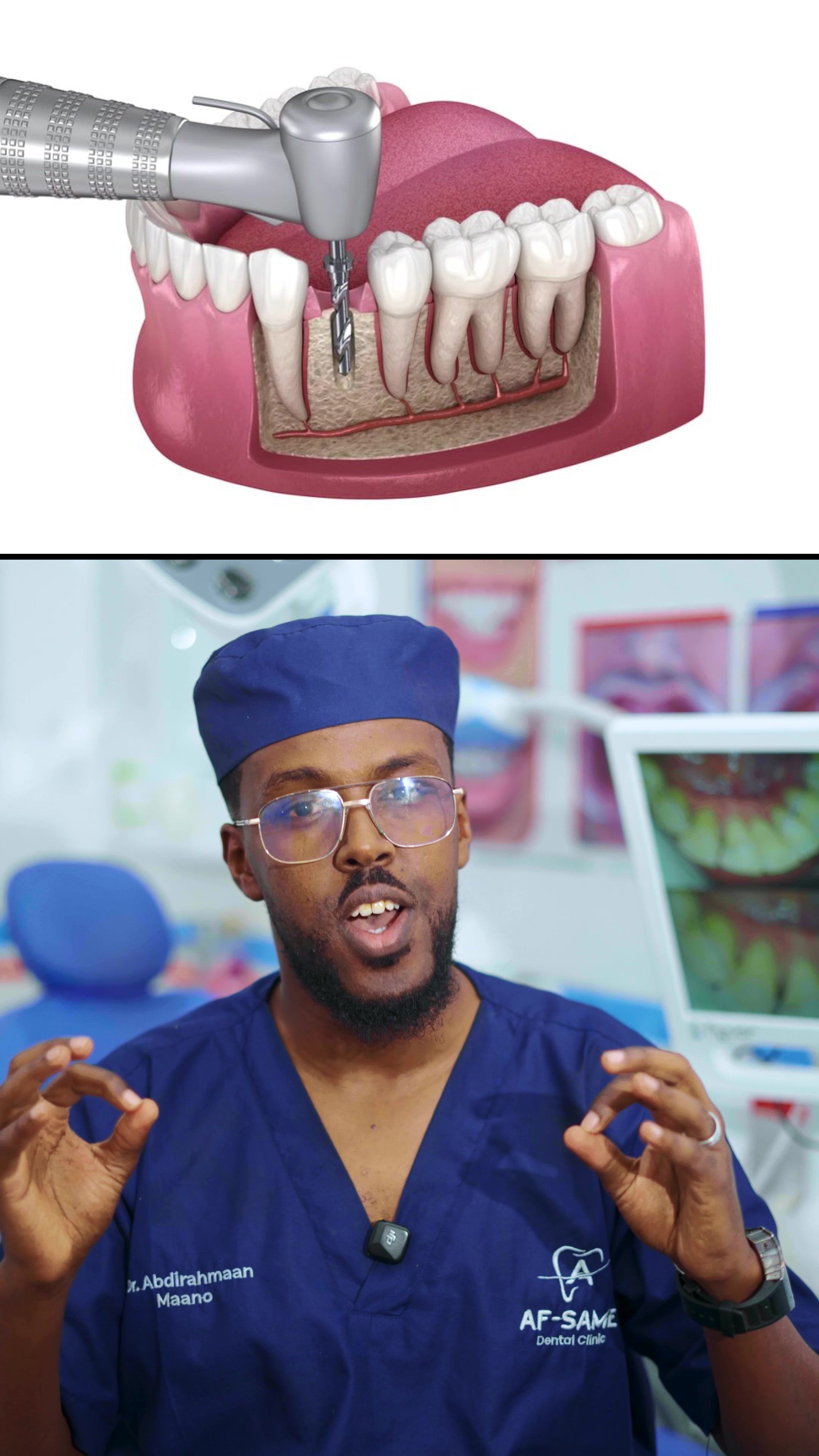 @Dr. Maano 🦷