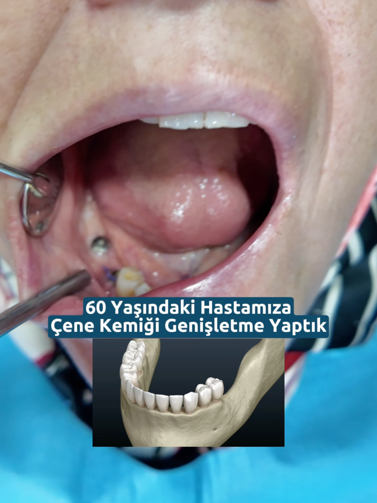 @Dr. Can Yemenicioğlu