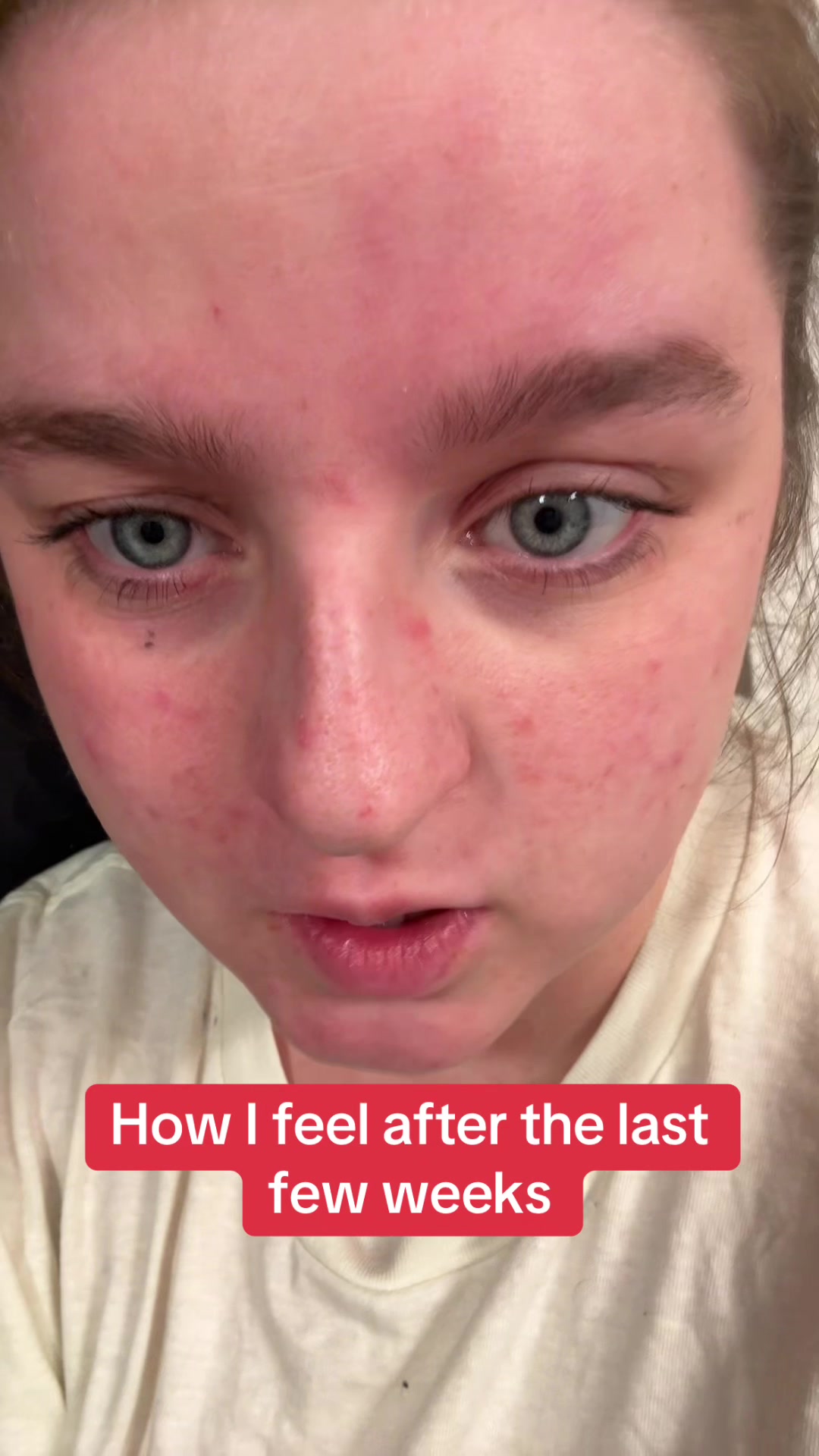 @ChronicallyCassie