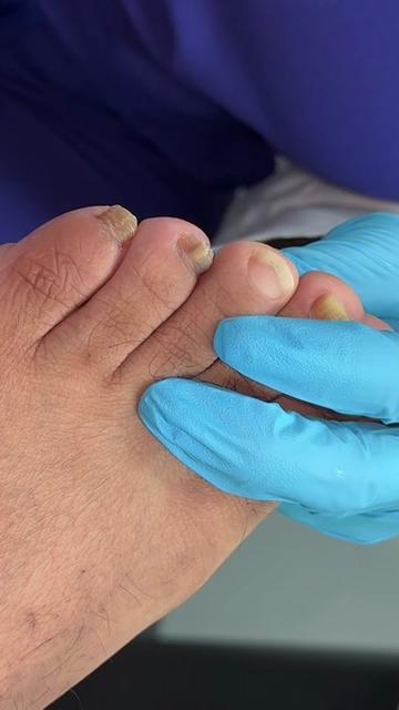 @Deniel Foot and Ankle Center