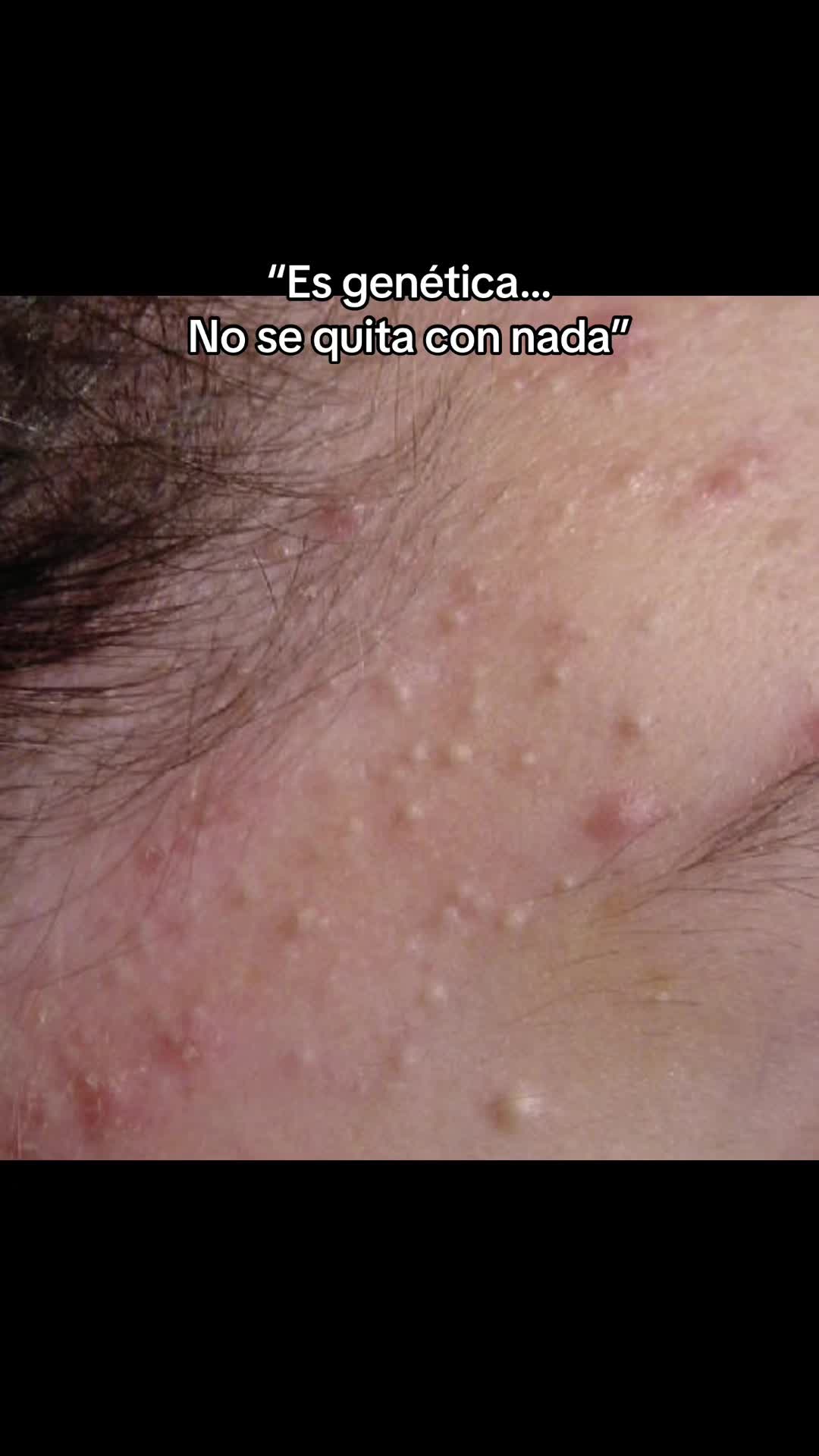 @Andy
