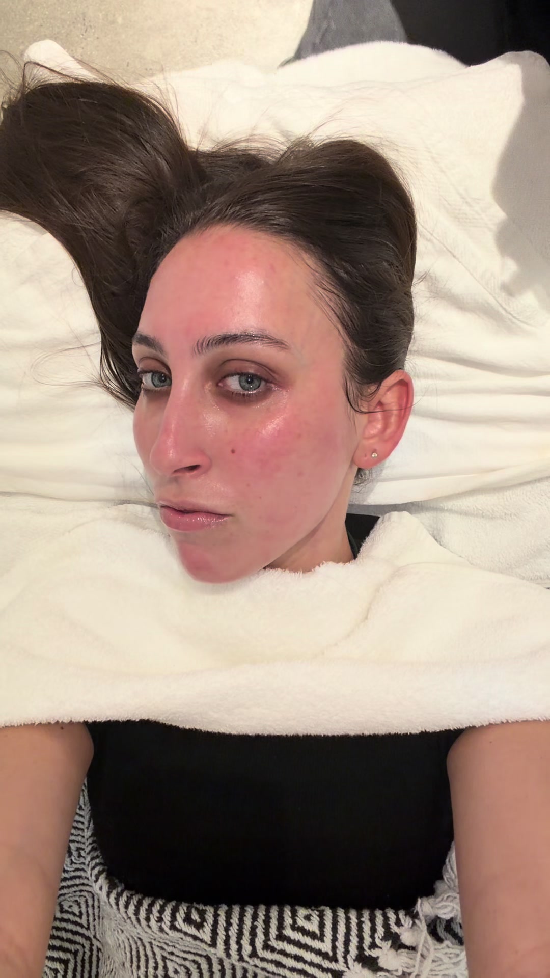 @SKINBYTW