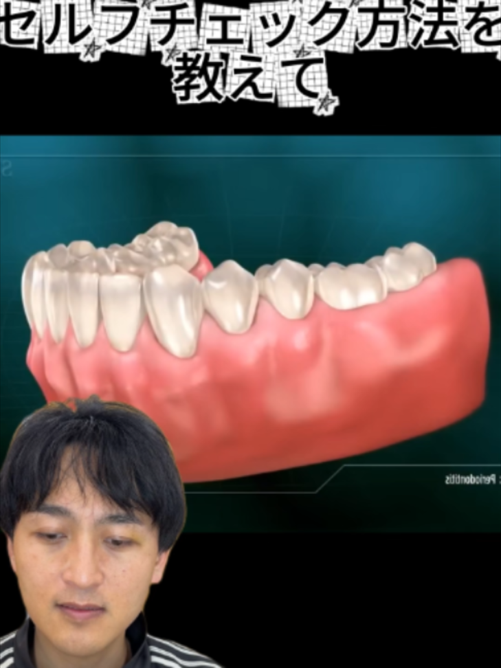 @金歯先生☆歯医者