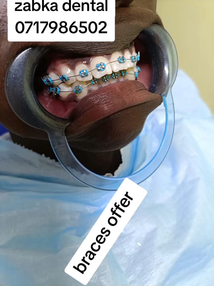 @Zabka Dental