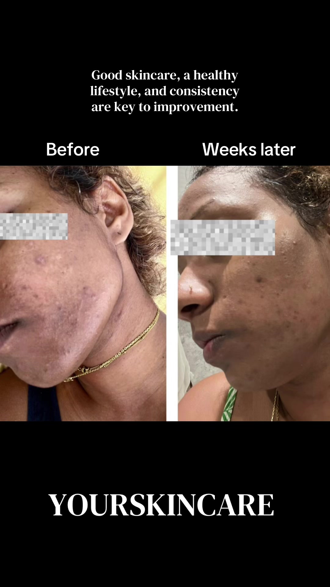 @YOURSKINCARE🇰🇷🇲🇺