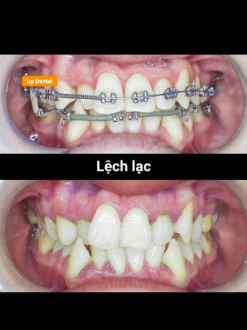 @Nha khoa niềng răng Up Dental