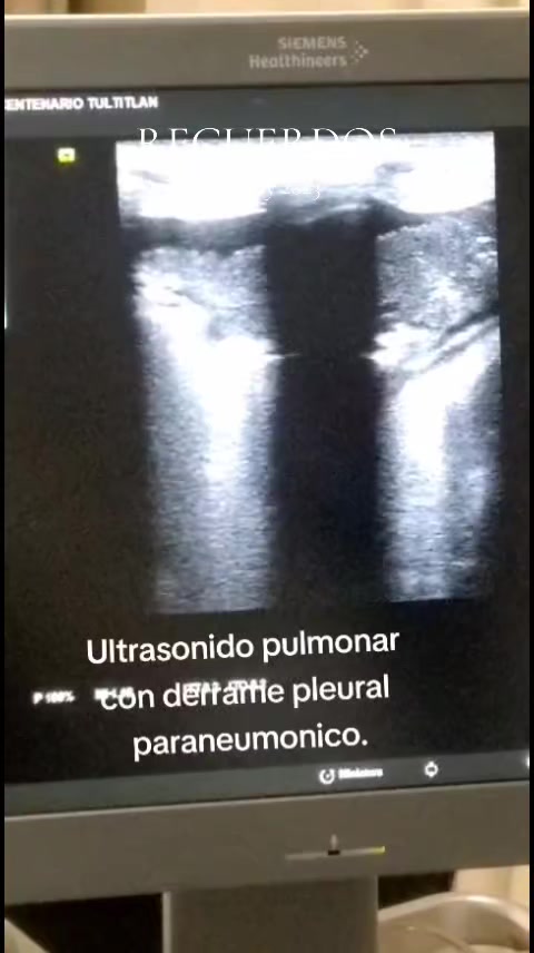 @Dr. Ajolote.