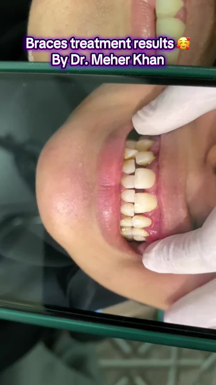 @dr_meher_official