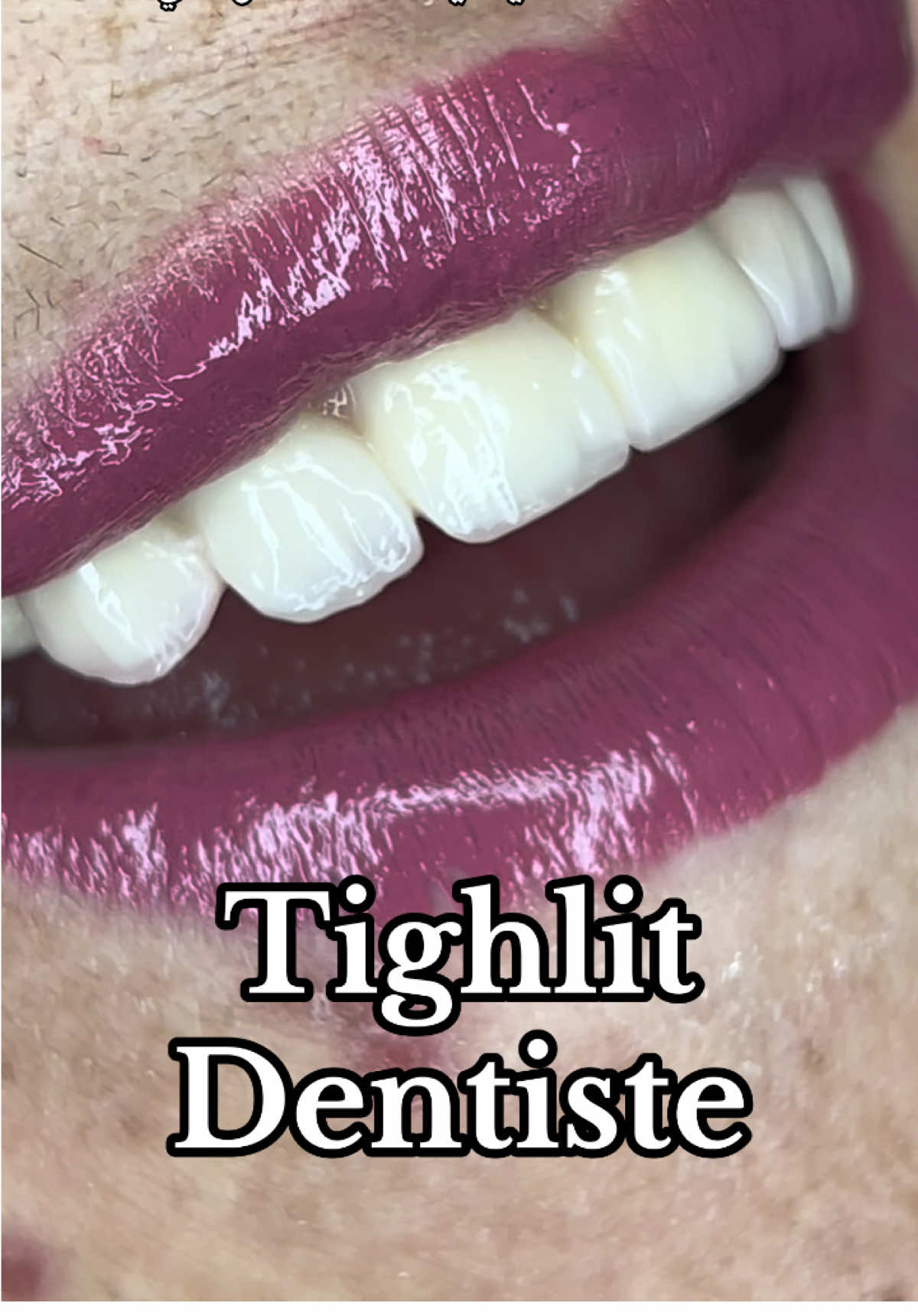 @tighlit_dentiste🦷