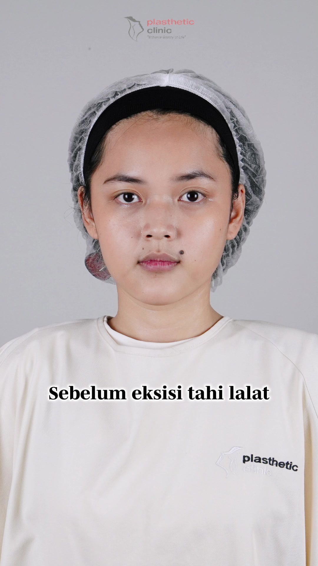 @Plasthetic Clinic