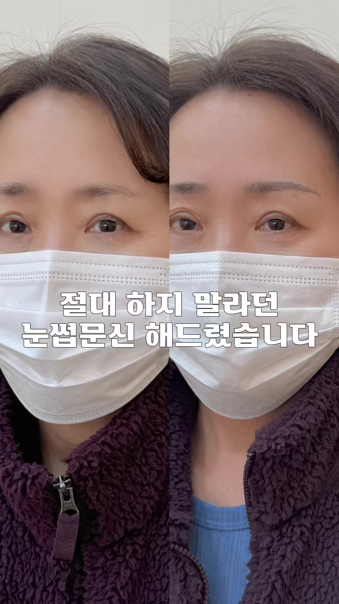 @강남눈썹문신|강남반영구 브로우뉴진