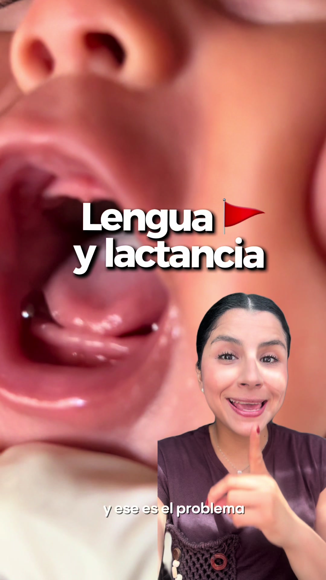 @Lizymarcekunilacta