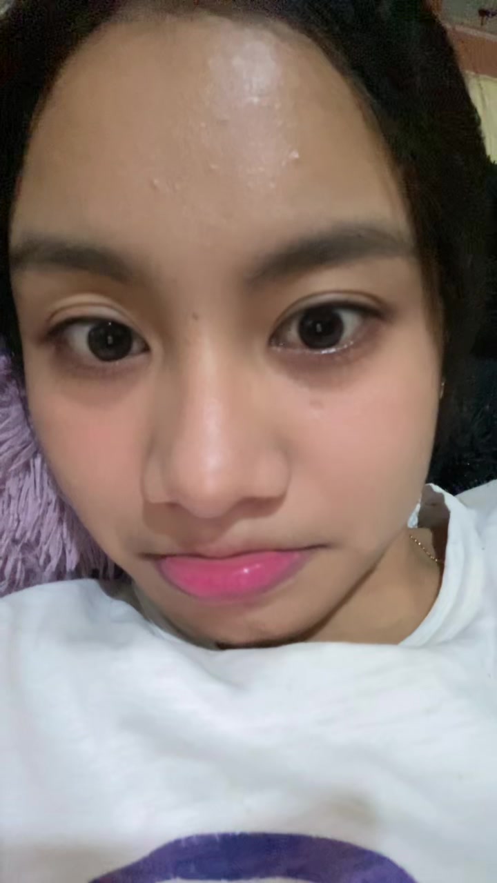 @irenecancer09