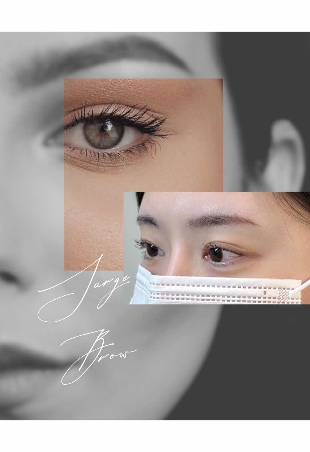 @써지브로우 surgebrow