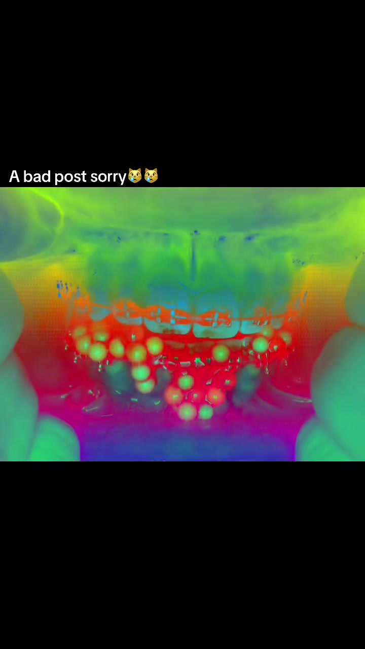 @⭐️//-Asher-//🦷