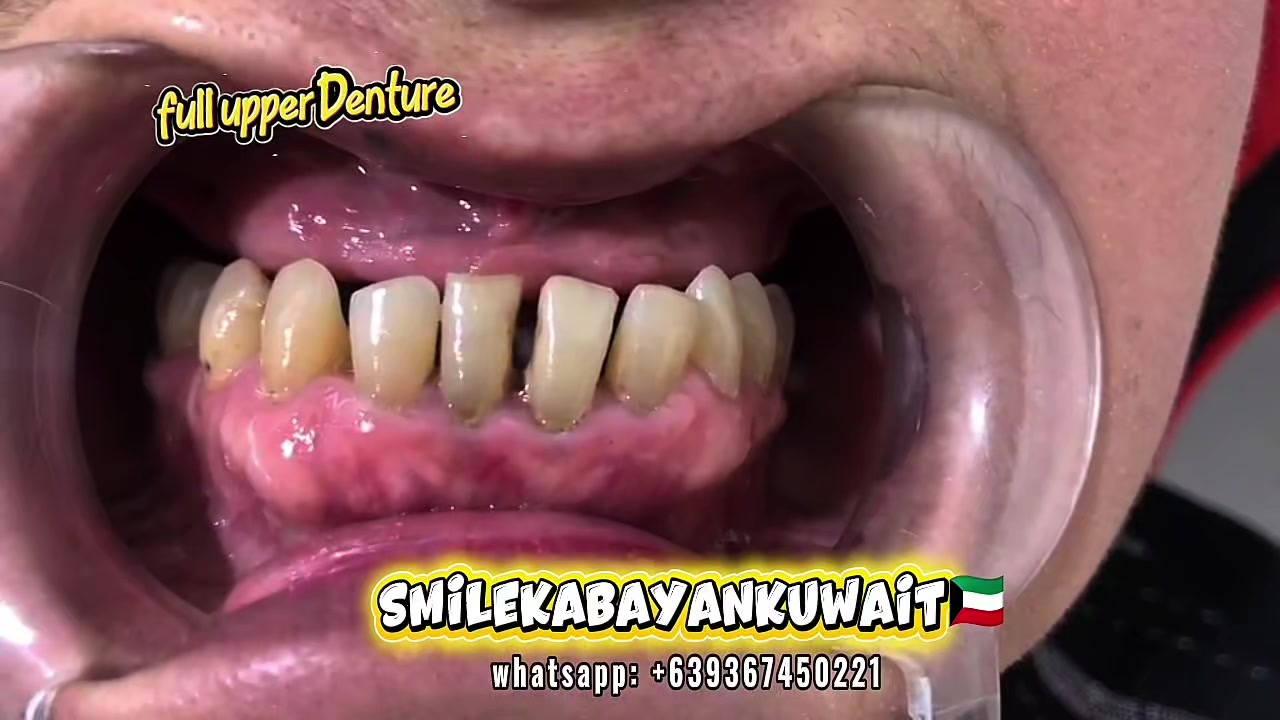 @SmileKabayanKuwait🇰🇼