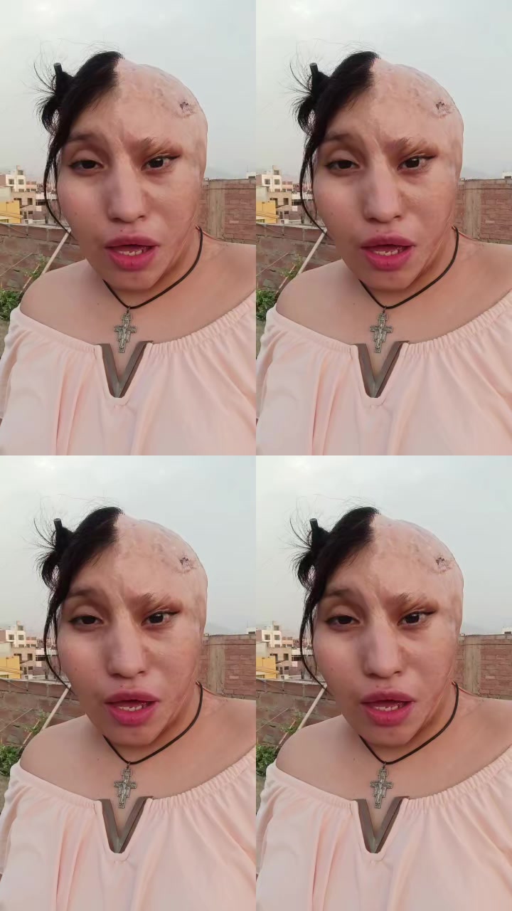 @Elizabeth Carrión