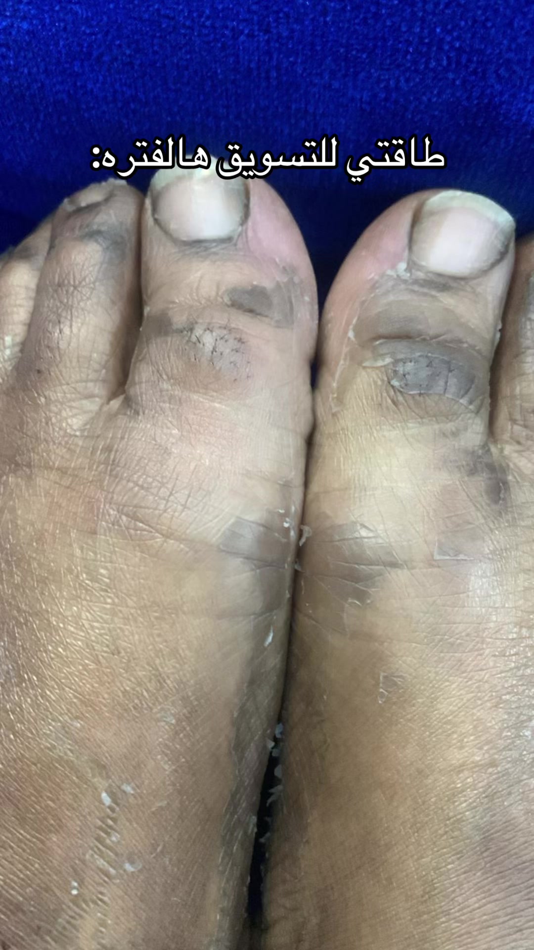 @هاي لينا| متجر قمر سابقاً