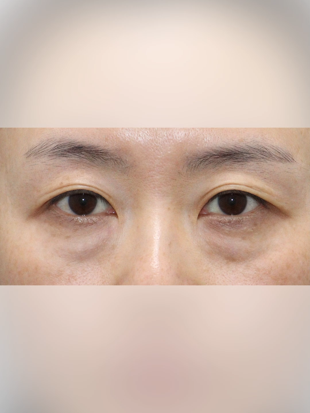 @다시피움성형외과 DASIPIUM タシピウム