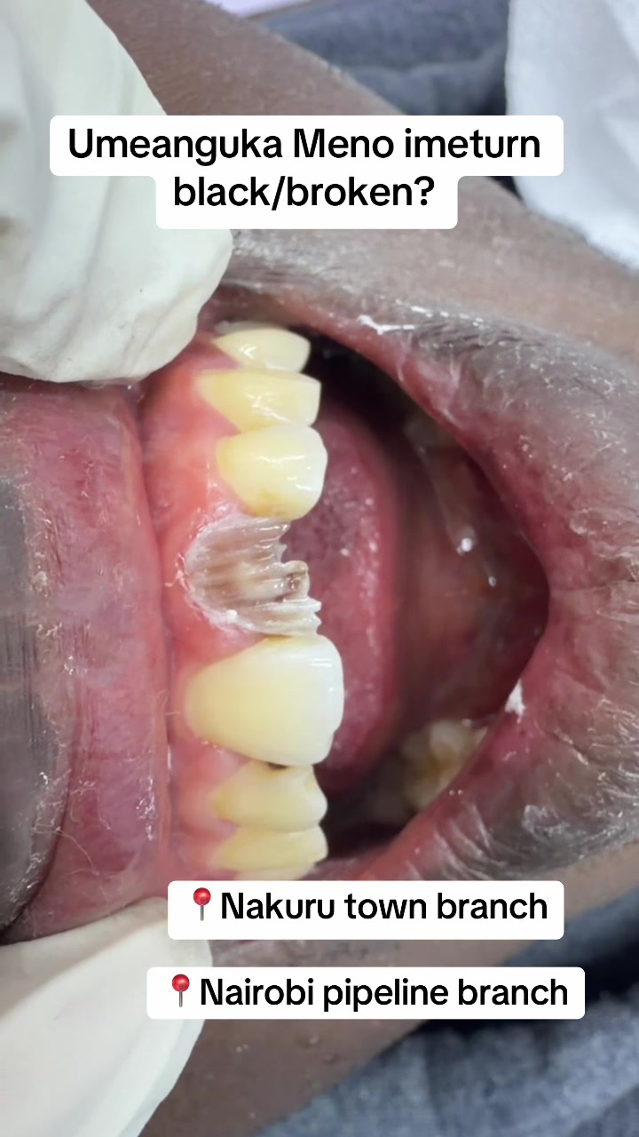 @Tiba dental care