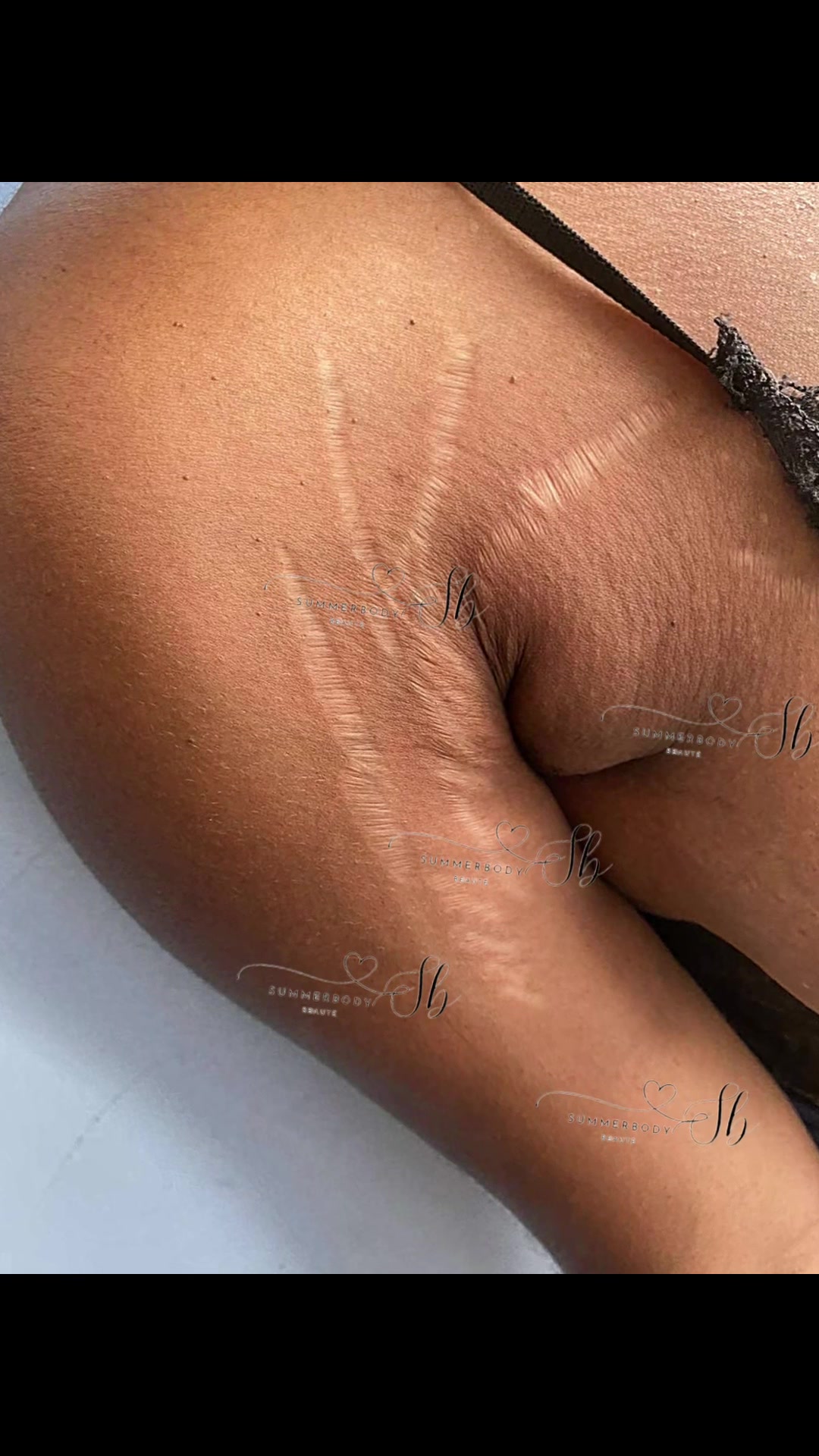 @summerbody