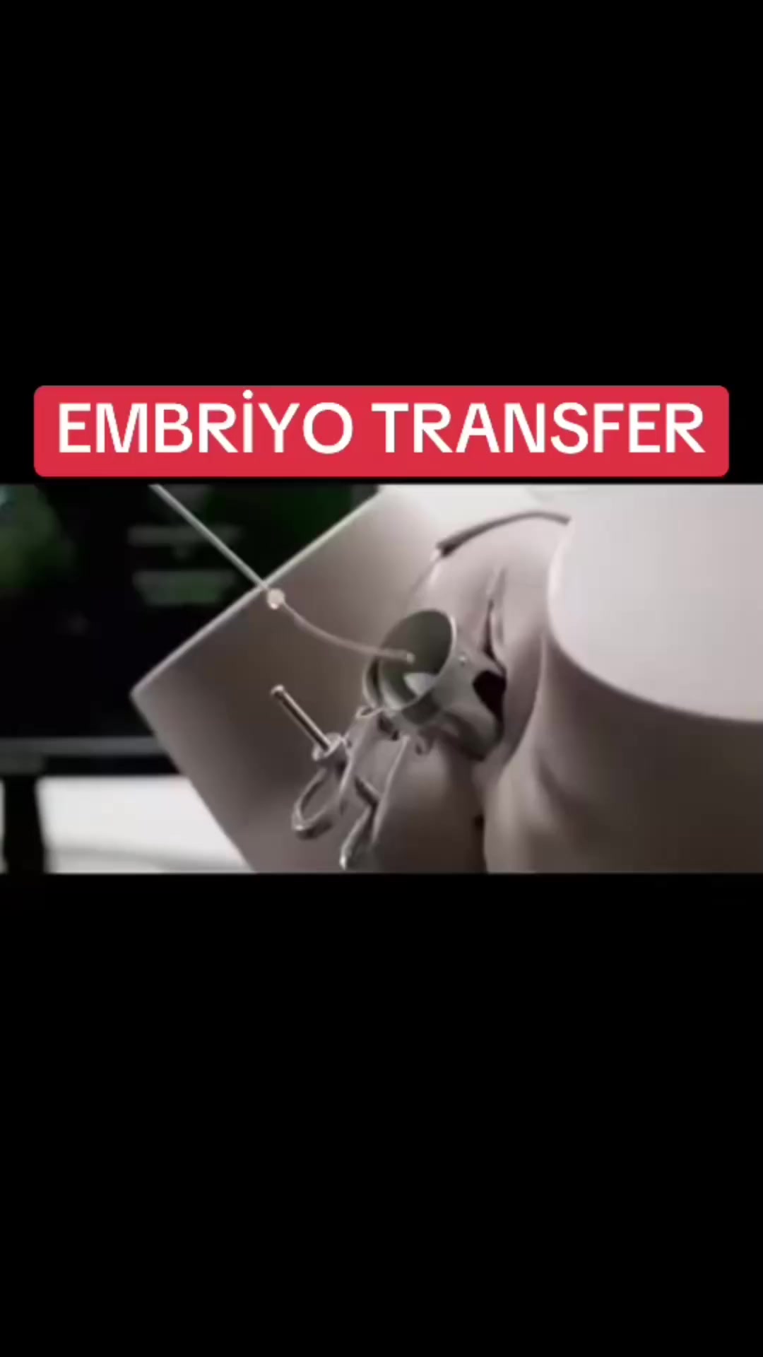 @Prenses ve Prens annesiyim🩵🩷