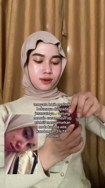 @dekgaluh