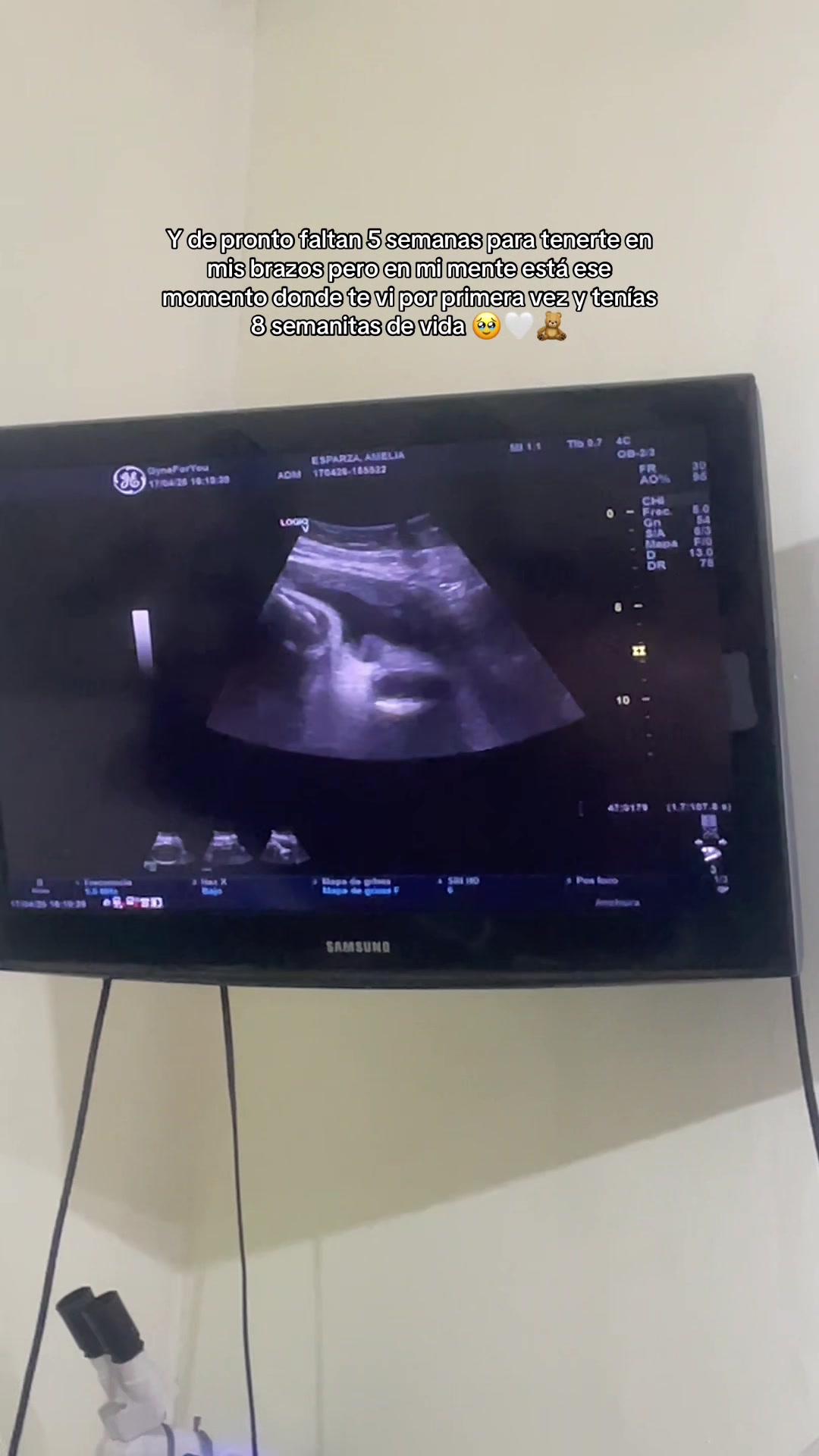 @Meli |||| Mom to be 🧸🩵
