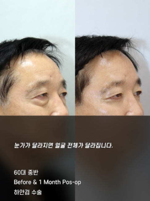 @다시피움성형외과 DASIPIUM タシピウム
