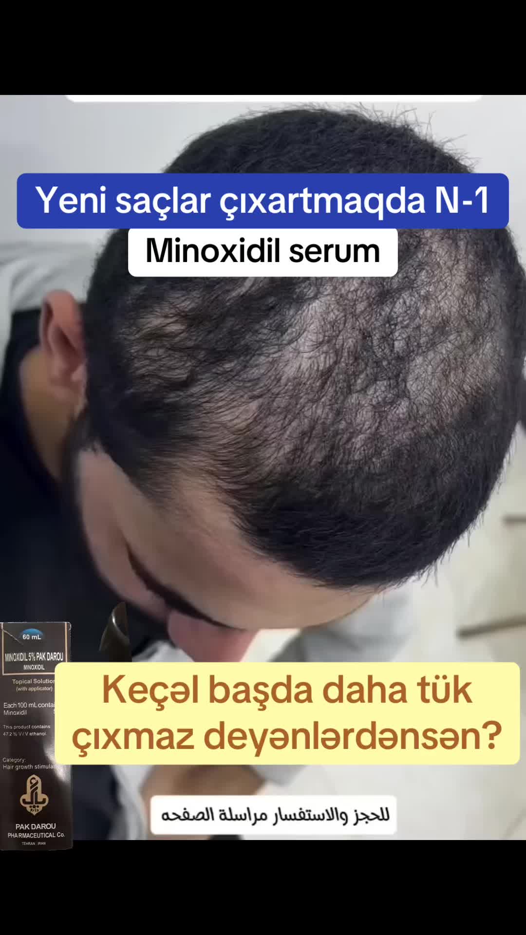 @T&uuml;k t&ouml;kən  Madura şam ağardıcı