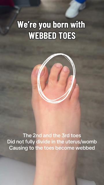@Deniel Foot and Ankle Center