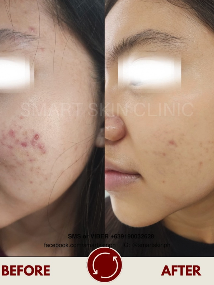 @The Smart Skin- Malolos