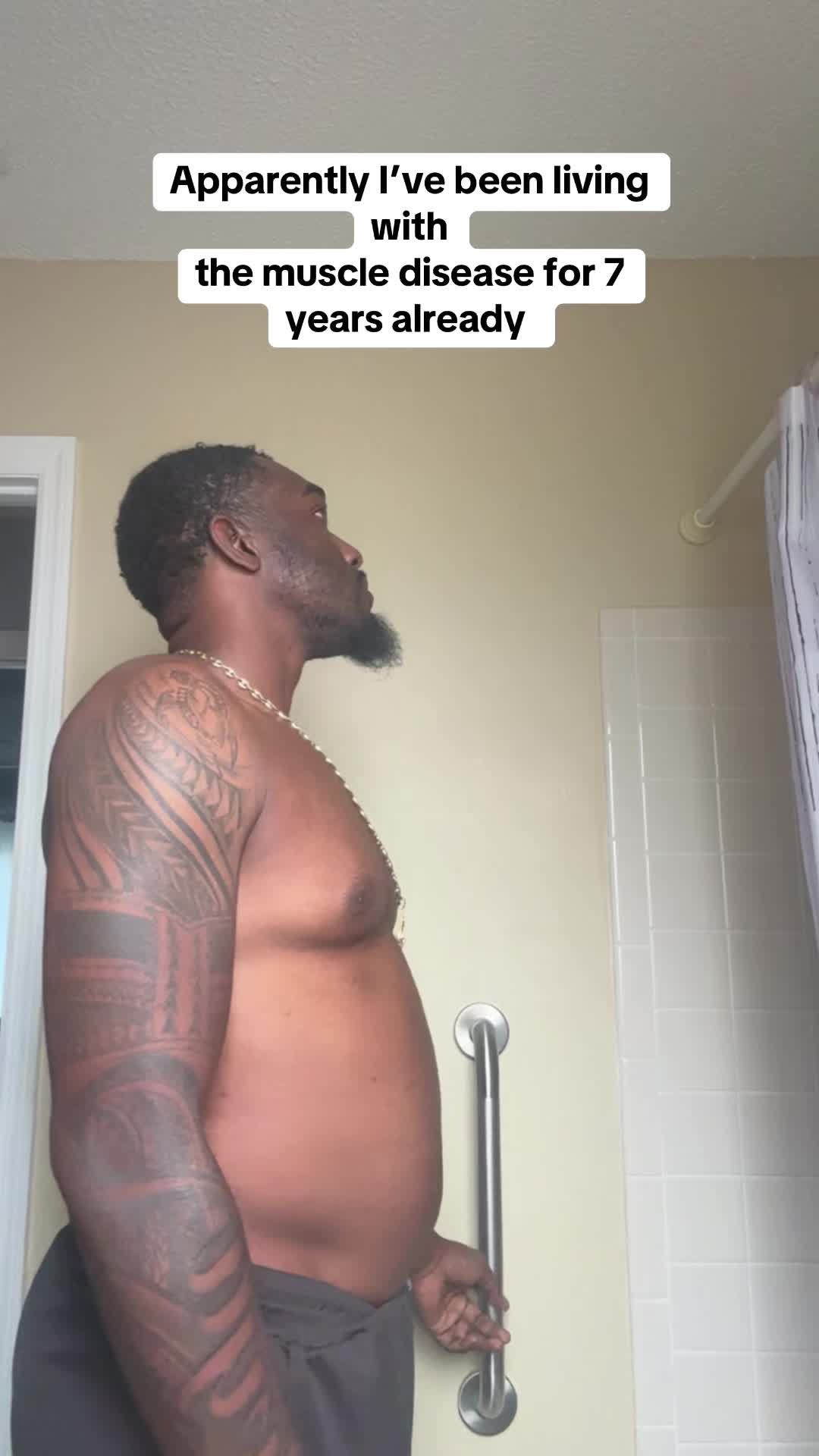 @Stervie🇩🇲Sterv👺