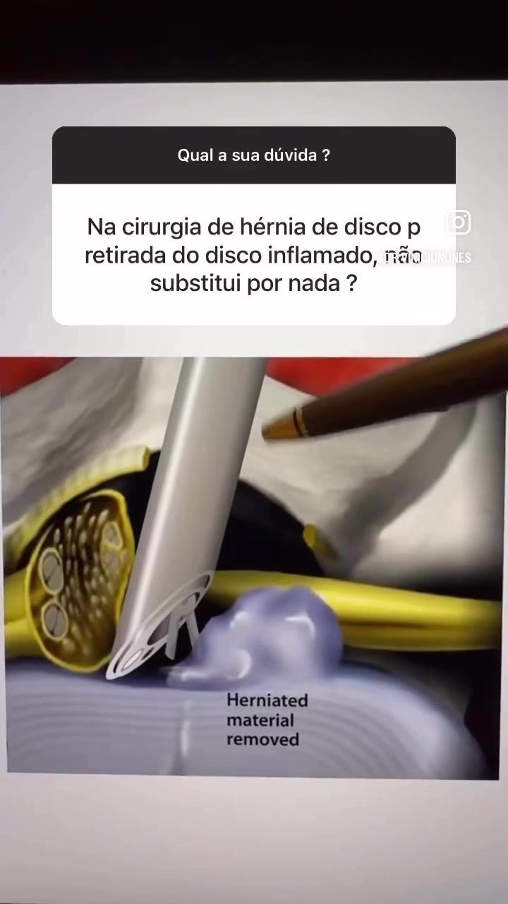 @Vinicio Nunes Nascimento