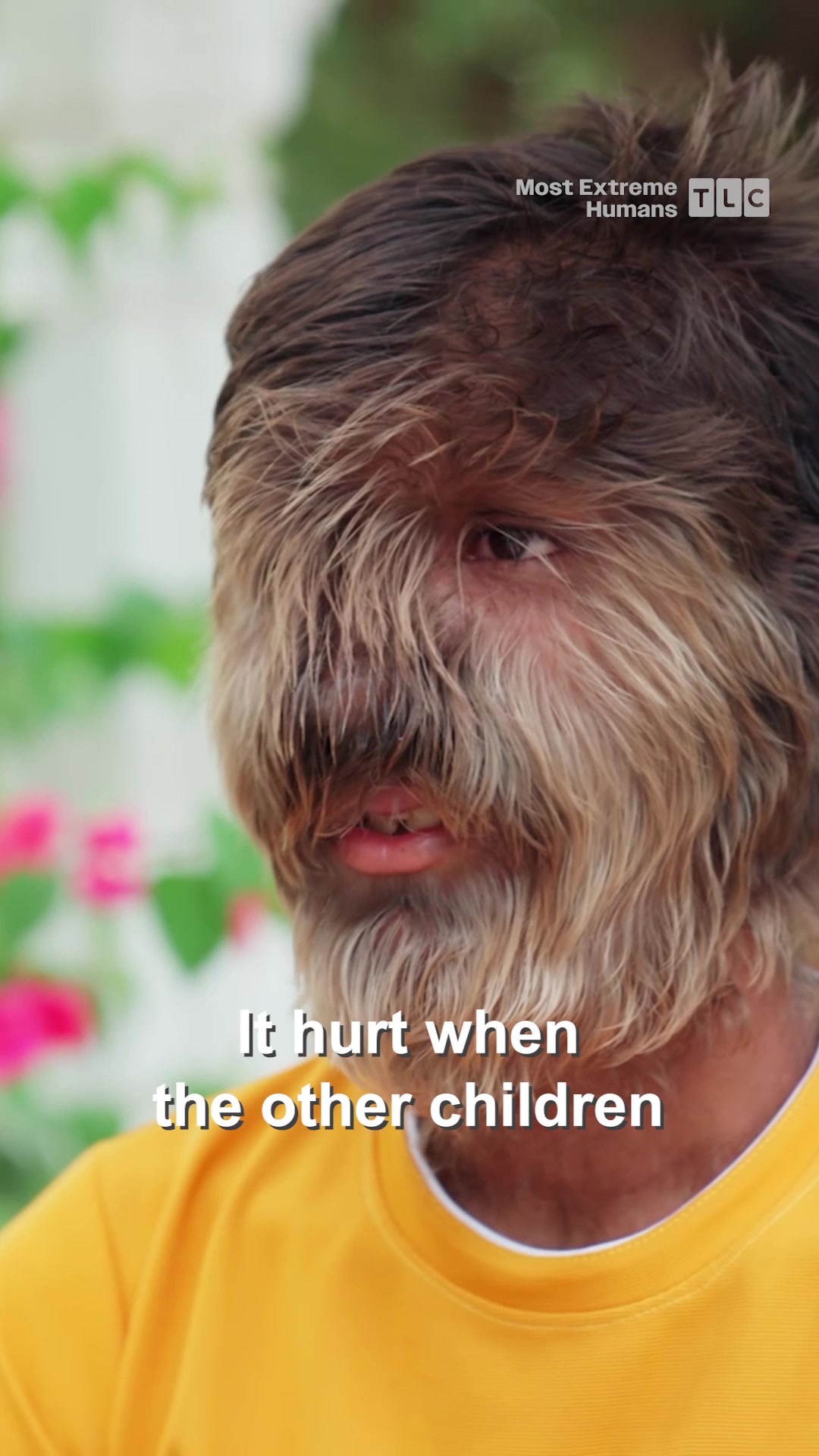 @tlc