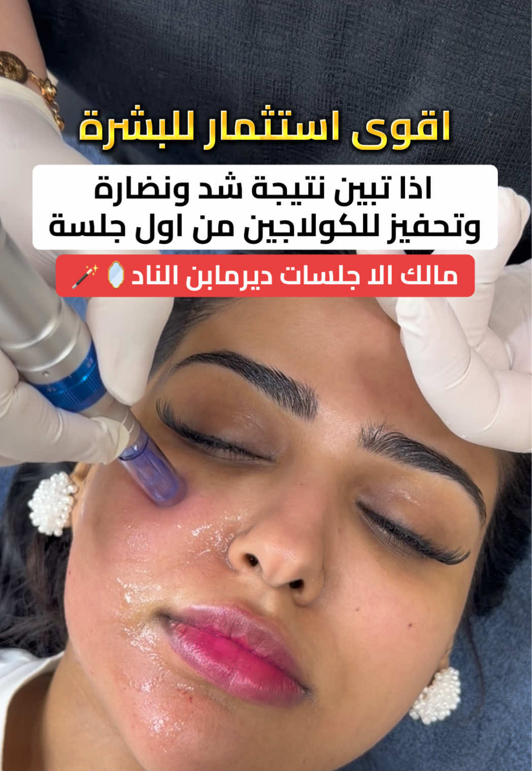 @أخصائية البشرة نورا