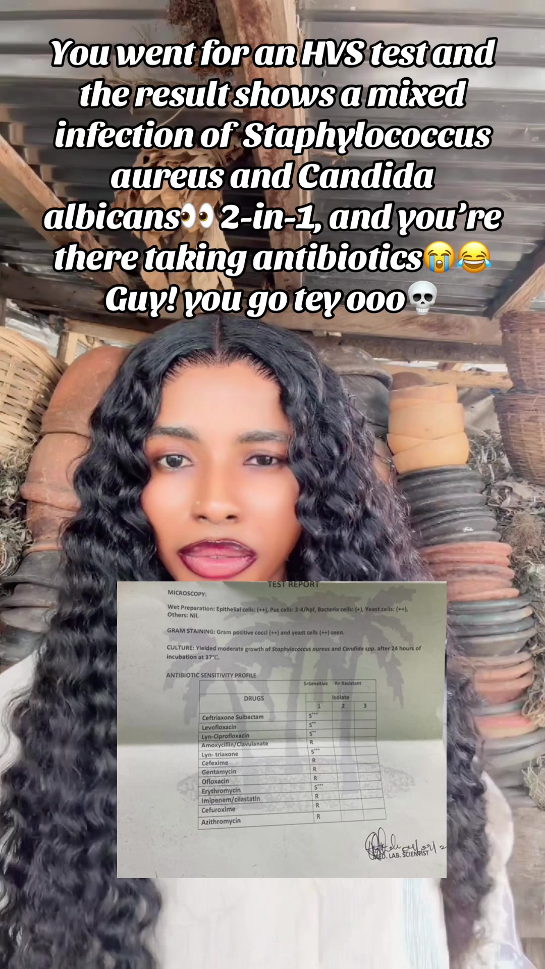 @GeNz_alagbo🐍🍯