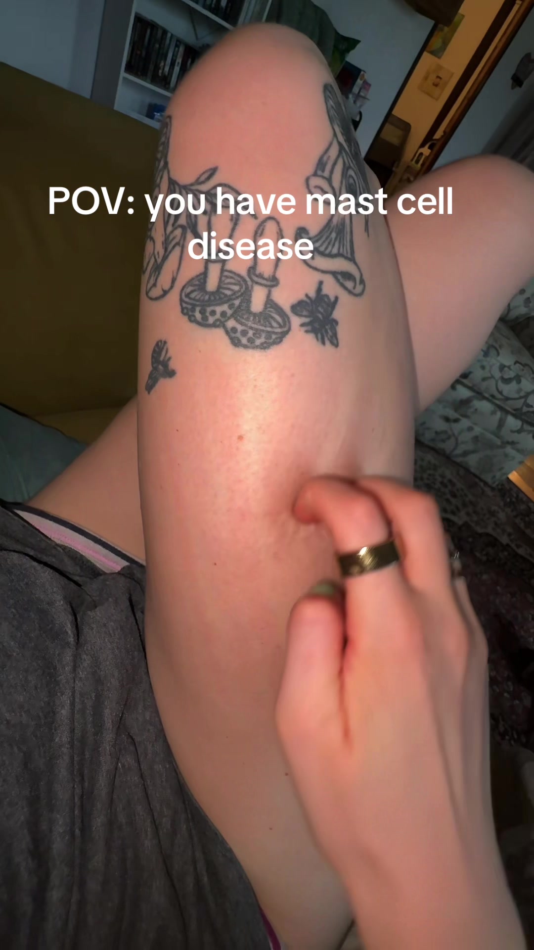 @indias_psoriasis