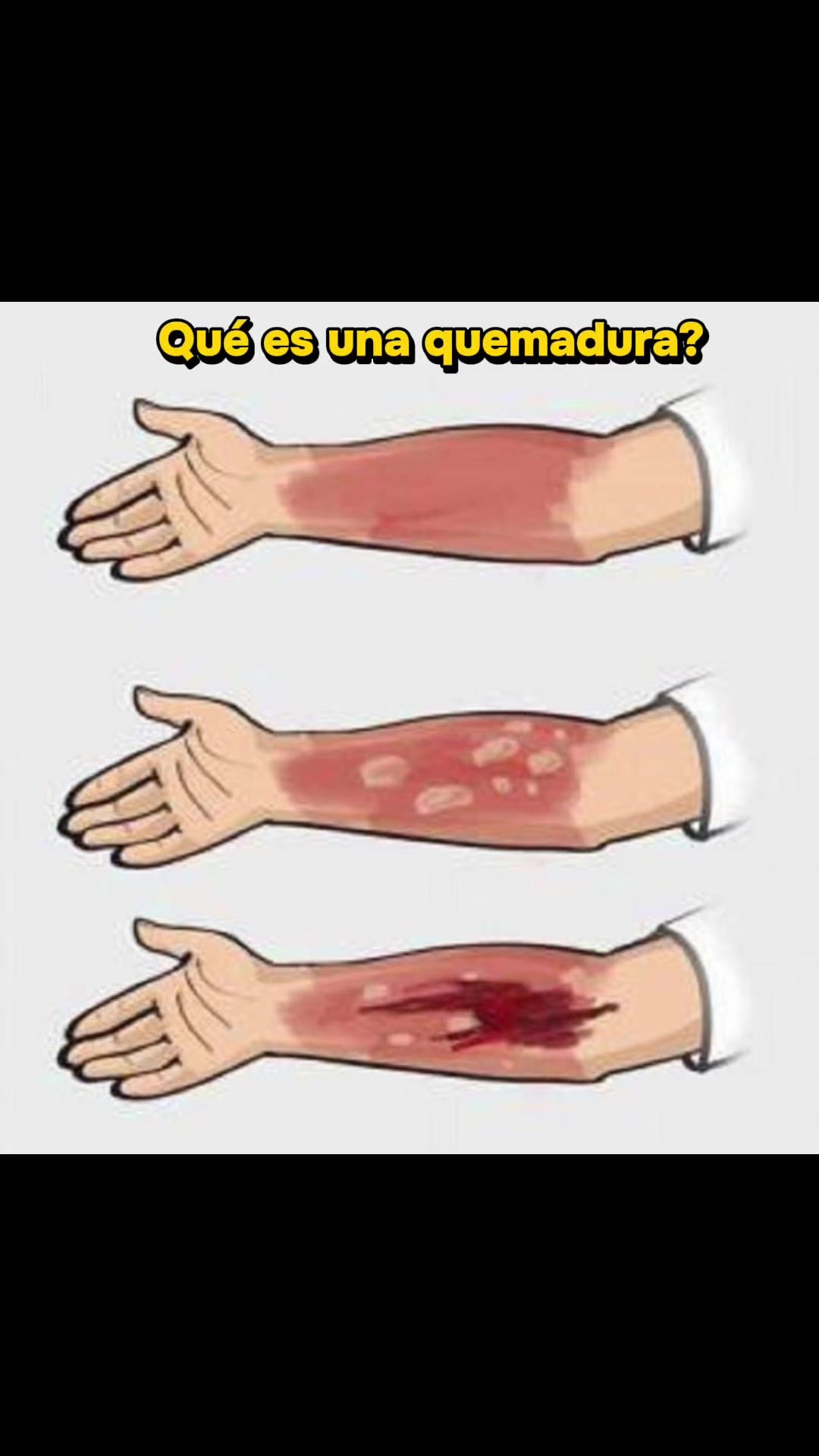 @🚒Emergencias Xtreme🚑