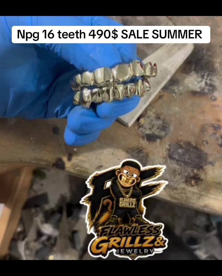@Flawless Grillz