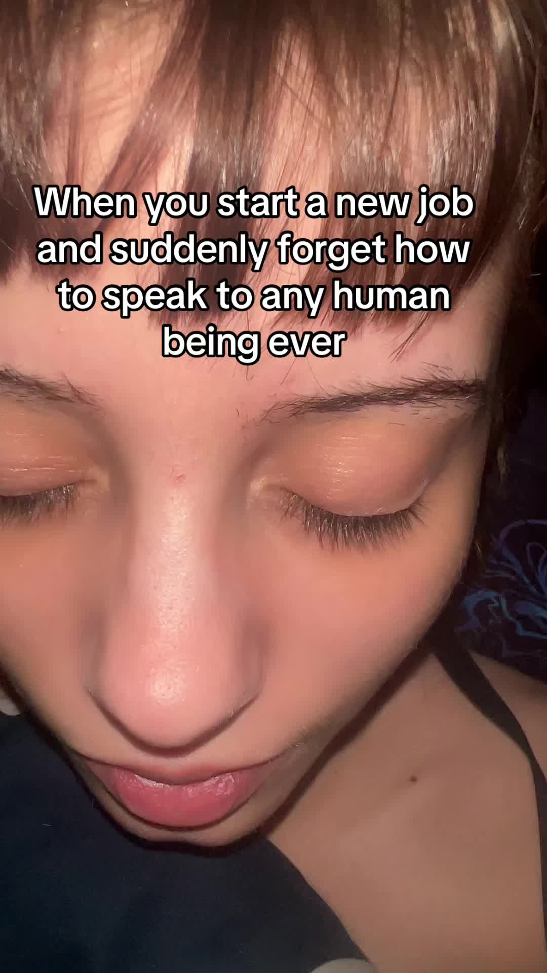 @sylvieferasurvives
