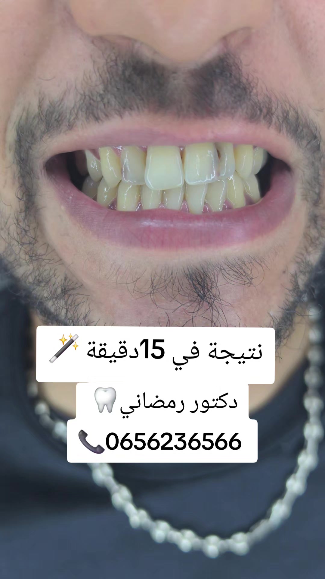 @Dr Ramdani Rassim