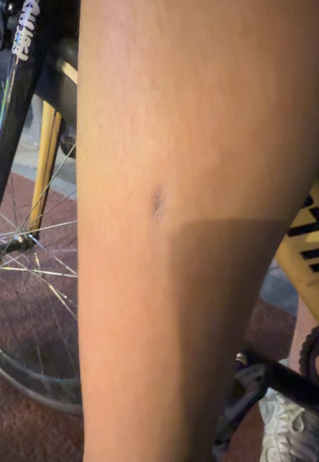 @리픽기 LIMIT Fixed Gear