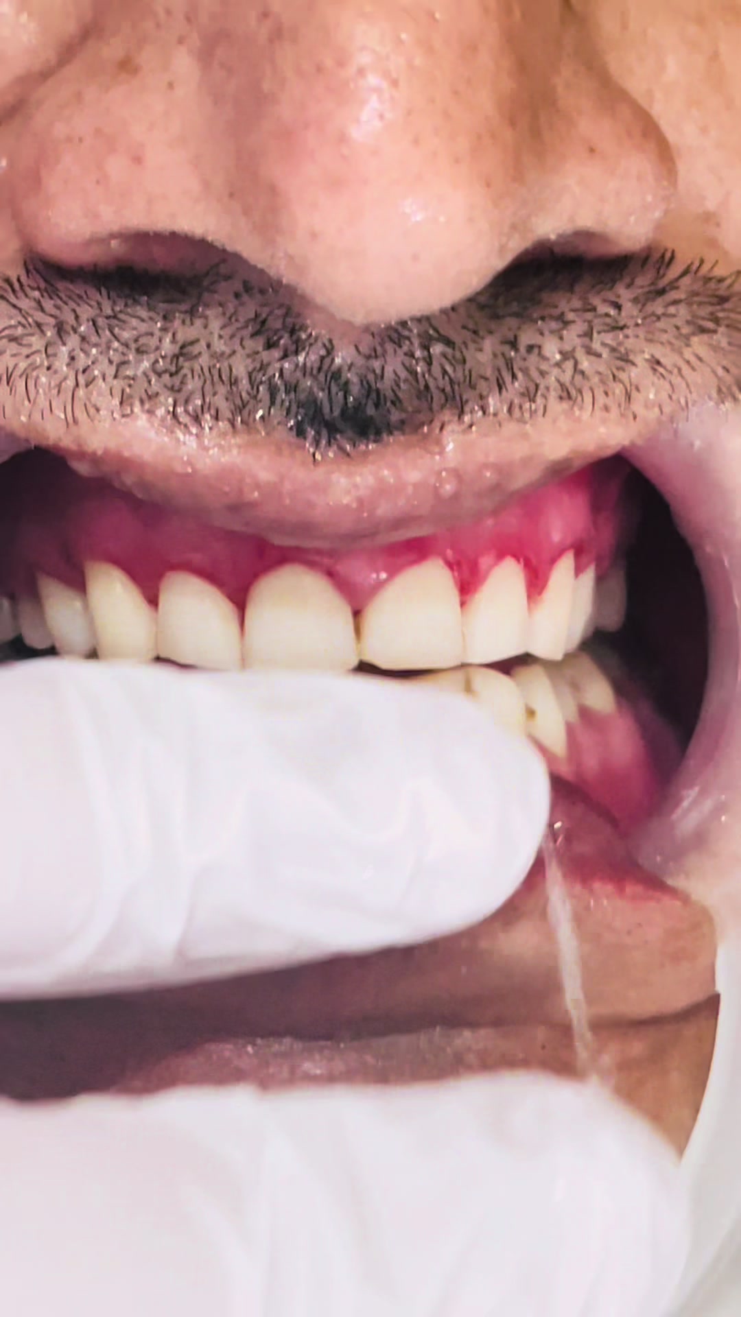 @Dr Sadiq Dawar Official 🦷