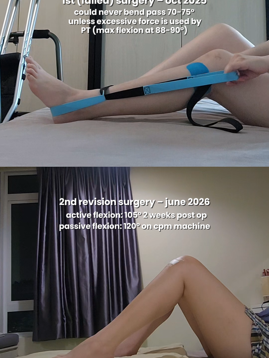 @🩼weinye🦵🏻✨mpfl recovery✨